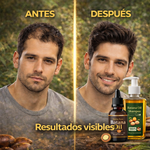 COMBO CAPILAR - ACEITE DE BATANA + SHAMPO DE BATANA | Tratamiento Completo Restauración Capilar ,100% natural